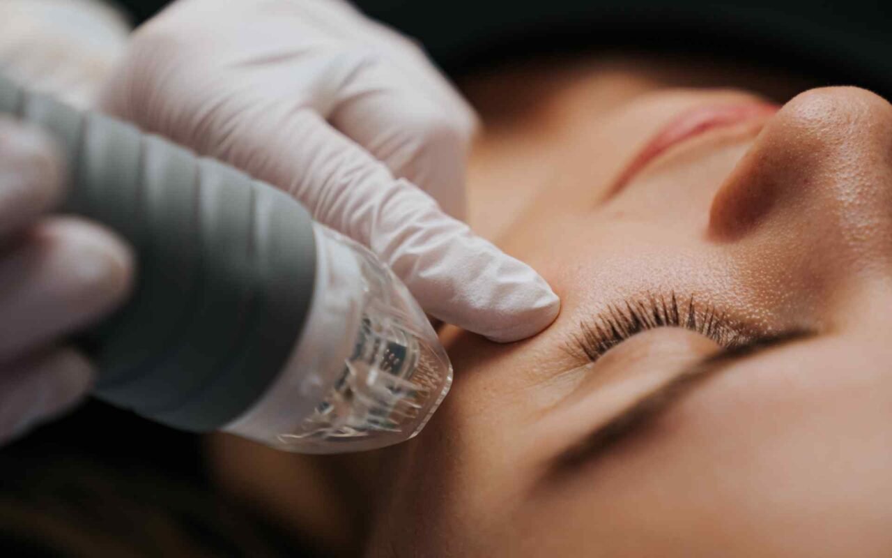 How RF Microneedling Improves Skin Texture and Elasticity