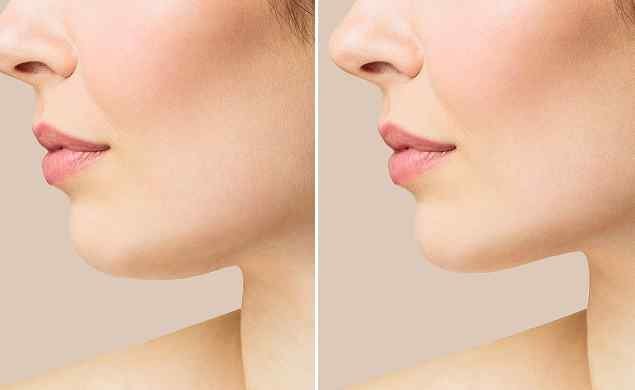 image_before_after_02 https://moroccan-treasure.com/wp-content/uploads/2026/05/image_before_after_02.jpg
